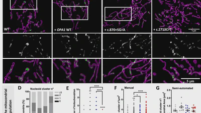 OPA1 and disease-causing mutants perturb mitochondrial nucleoid distribution featured image